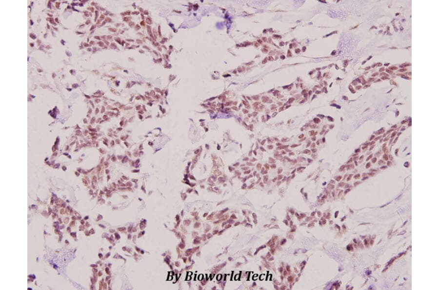 Anti-HKR1 (W154) Antibody from Bioworld Technology (BS1923) - Antibodies.com