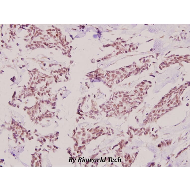 Anti-HKR1 (W154) Antibody from Bioworld Technology (BS1923) - Antibodies.com
