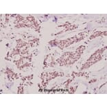 Anti-HKR1 (W154) Antibody from Bioworld Technology (BS1923) - Antibodies.com