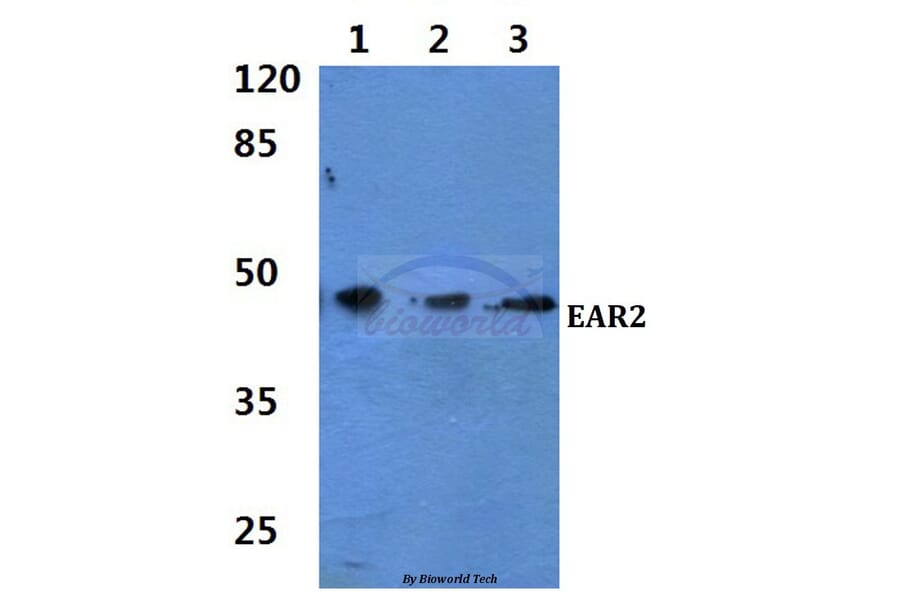 Anti-EAR2 (S40) Antibody from Bioworld Technology (BS1925) - Antibodies.com