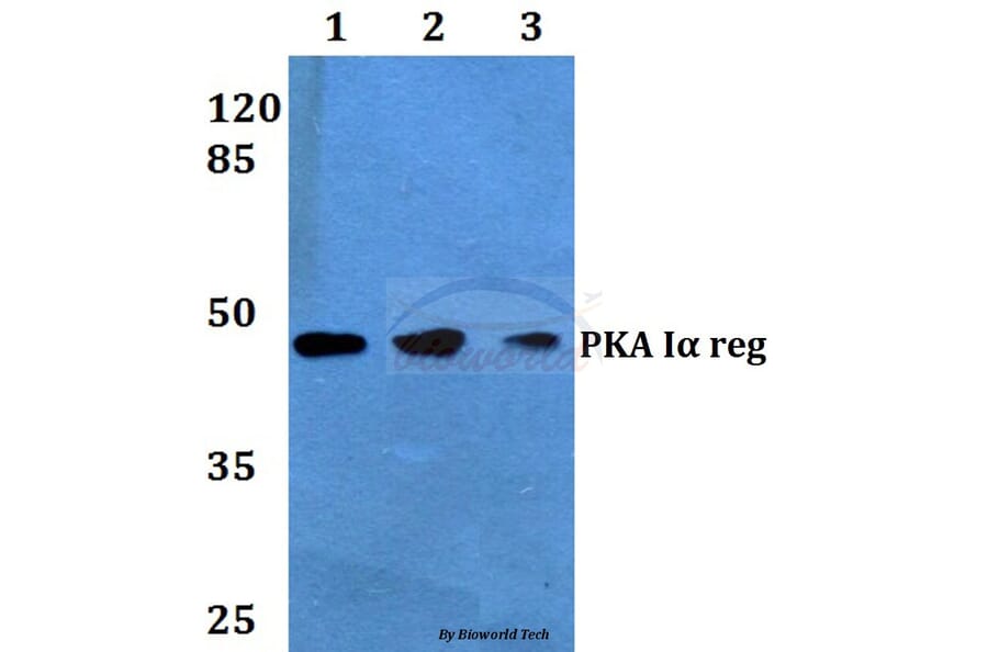 Anti-PKA Iα reg (Q304) Antibody from Bioworld Technology (BS1926) - Antibodies.com