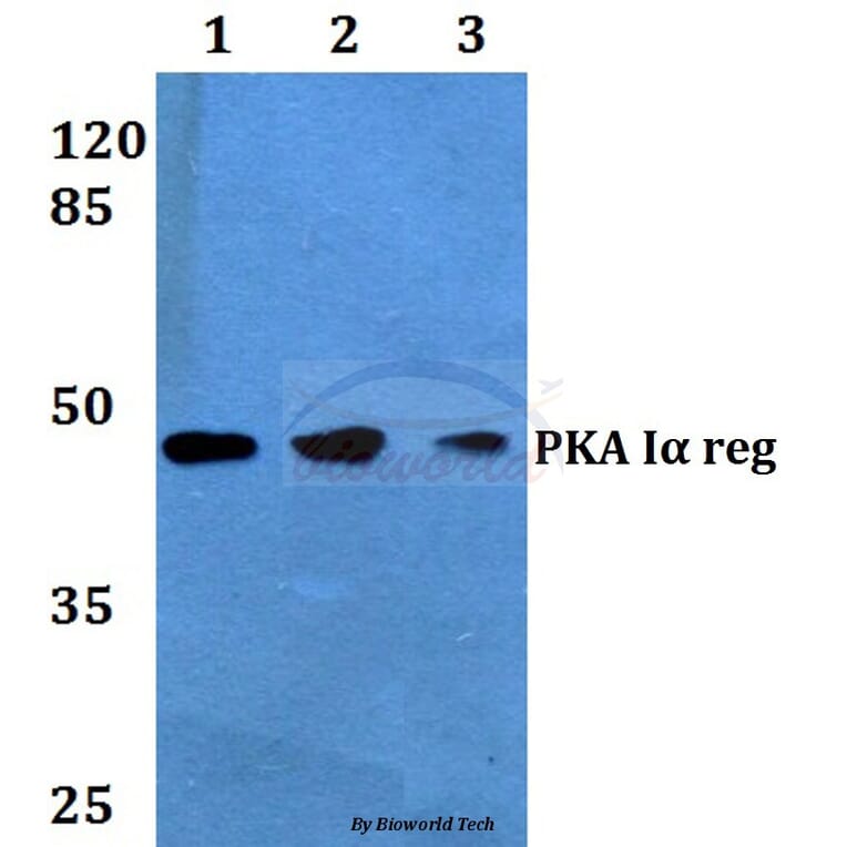Anti-PKA Iα reg (Q304) Antibody from Bioworld Technology (BS1926) - Antibodies.com