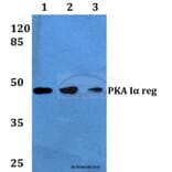 Anti-PKA Iα reg (Q304) Antibody from Bioworld Technology (BS1926) - Antibodies.com