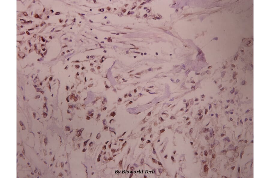 Anti-PKA Iα reg (Q304) Antibody from Bioworld Technology (BS1926) - Antibodies.com