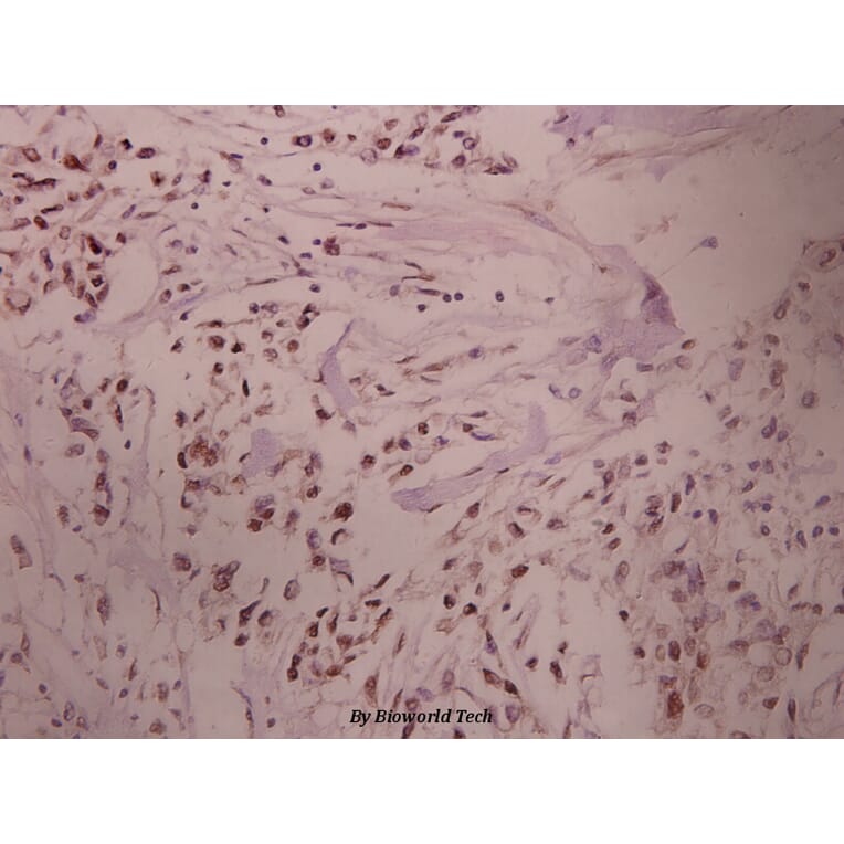 Anti-PKA Iα reg (Q304) Antibody from Bioworld Technology (BS1926) - Antibodies.com