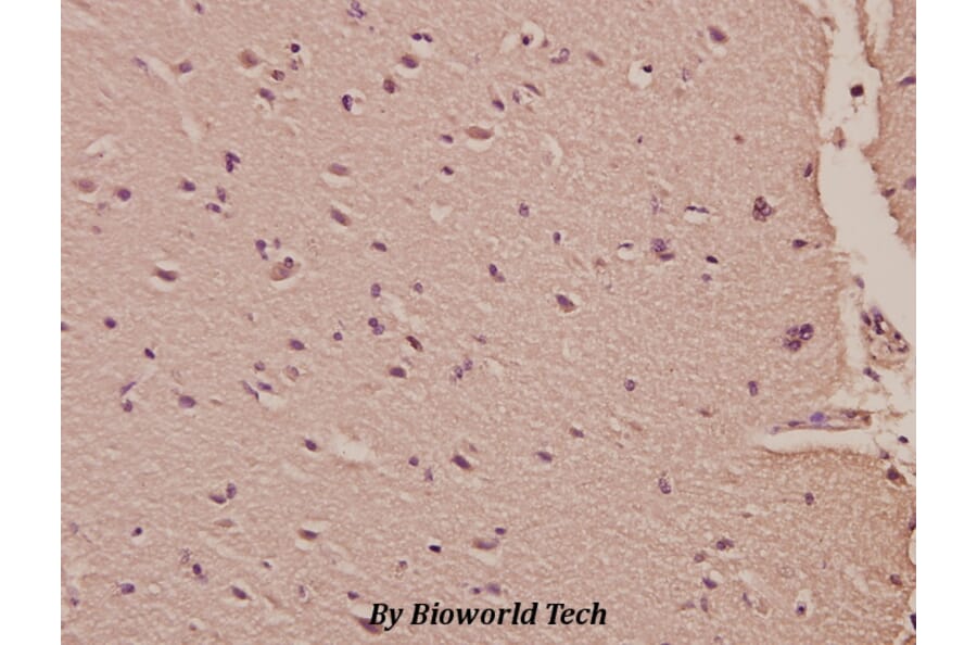 Anti-HisRS (E492) Antibody from Bioworld Technology (BS1927) - Antibodies.com