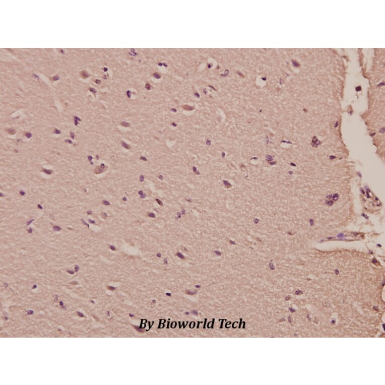 Anti-HisRS (E492) Antibody from Bioworld Technology (BS1927) - Antibodies.com