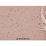 Anti-HisRS (E492) Antibody from Bioworld Technology (BS1927) - Antibodies.com