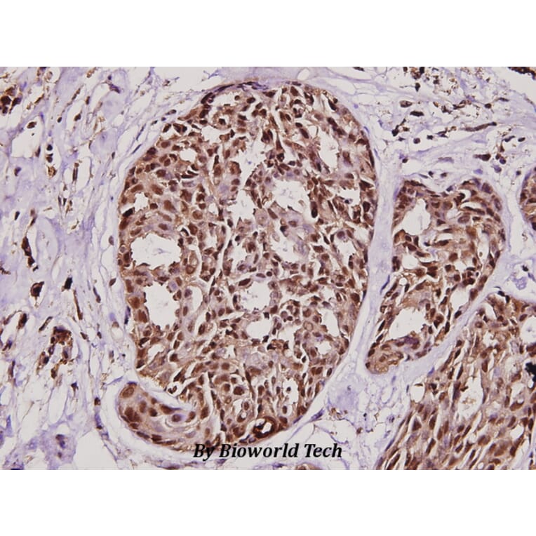 Anti-HRF (K100) Antibody from Bioworld Technology (BS1928) - Antibodies.com