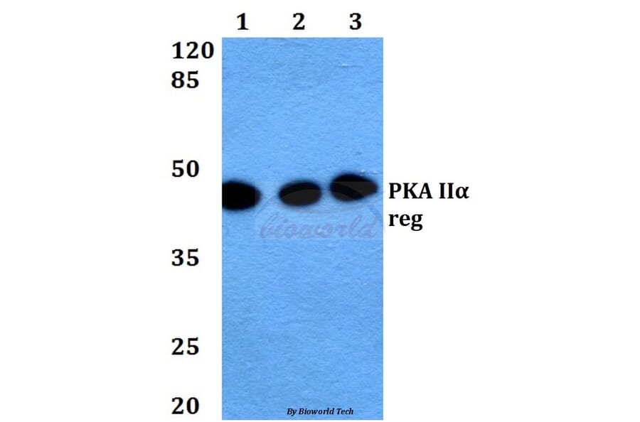 Anti-PKA IIα reg (P68) Antibody from Bioworld Technology (BS1929) - Antibodies.com