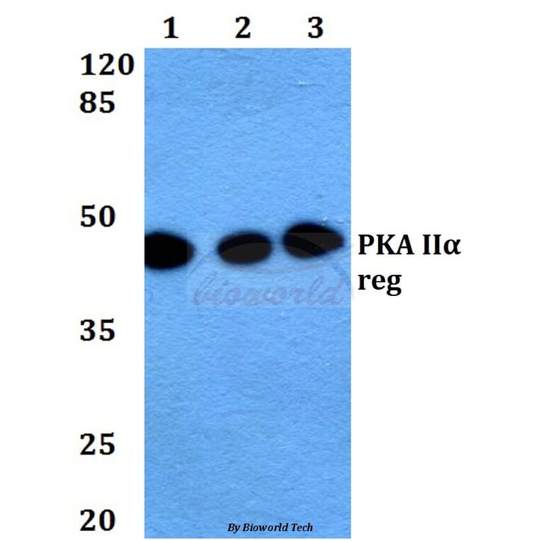 Anti-PKA IIα reg (P68) Antibody from Bioworld Technology (BS1929) - Antibodies.com
