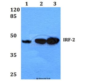 Anti-IRF-2 (K129) Antibody from Bioworld Technology (BS1930) - Antibodies.com