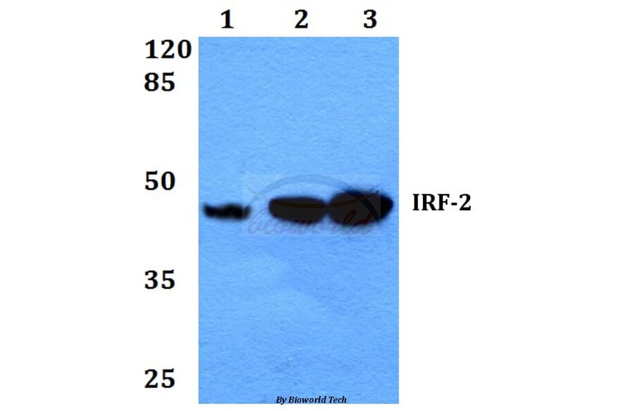 Anti-IRF-2 (K129) Antibody from Bioworld Technology (BS1930) - Antibodies.com