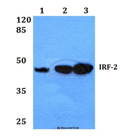 Anti-IRF-2 (K129) Antibody from Bioworld Technology (BS1930) - Antibodies.com