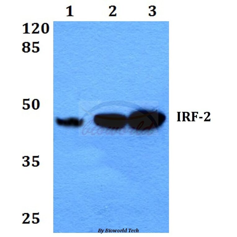 Anti-IRF-2 (K129) Antibody from Bioworld Technology (BS1930) - Antibodies.com