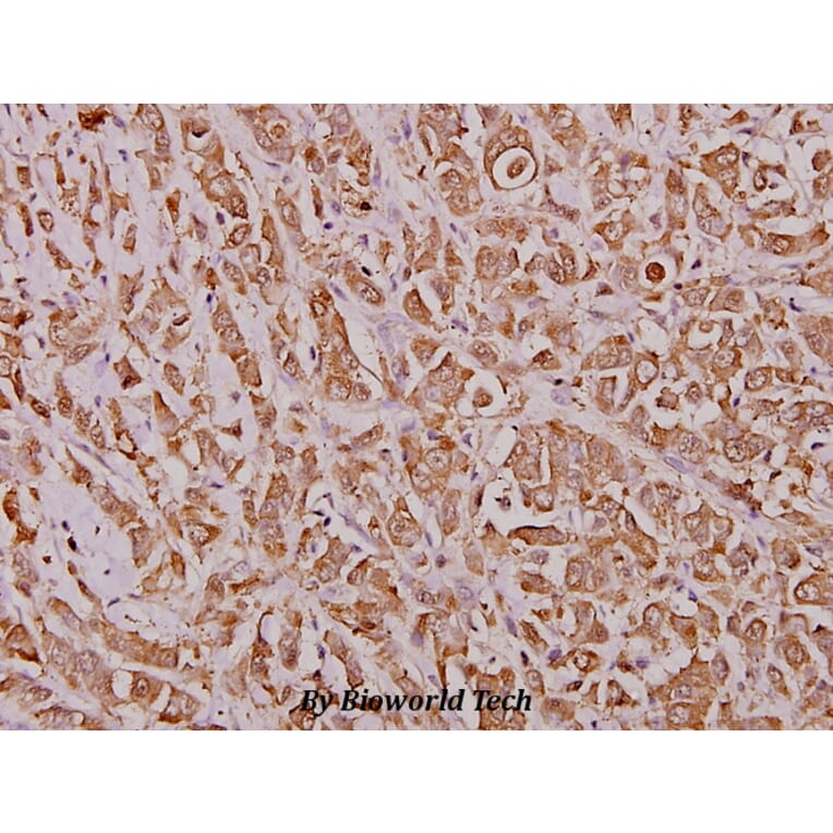 Anti-IRF-2 (K129) Antibody from Bioworld Technology (BS1930) - Antibodies.com
