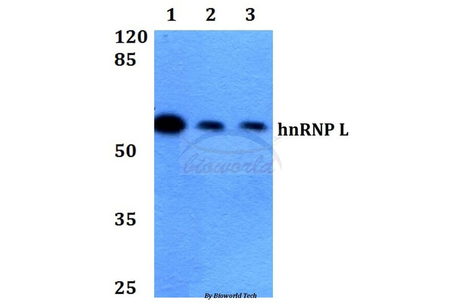 Anti-hnRNP L (G58) Antibody from Bioworld Technology (BS1931) - Antibodies.com