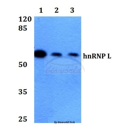 Anti-hnRNP L (G58) Antibody from Bioworld Technology (BS1931) - Antibodies.com