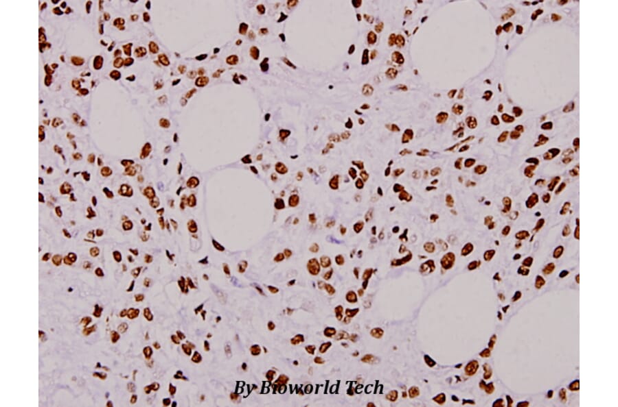 Anti-hnRNP L (G58) Antibody from Bioworld Technology (BS1931) - Antibodies.com
