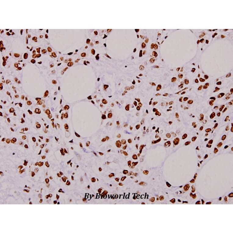 Anti-hnRNP L (G58) Antibody from Bioworld Technology (BS1931) - Antibodies.com