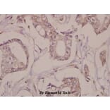 Anti-Fra-1 (D134) Antibody from Bioworld Technology (BS1933) - Antibodies.com