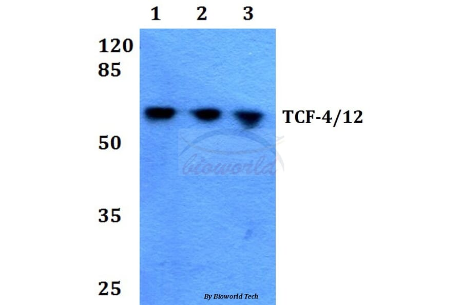 Anti-TCF-4/12 (S616) Antibody from Bioworld Technology (BS1934) - Antibodies.com