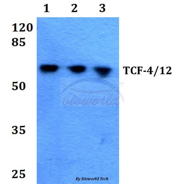 Anti-TCF-4/12 (S616) Antibody from Bioworld Technology (BS1934) - Antibodies.com