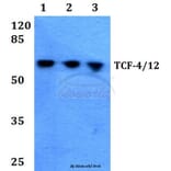 Anti-TCF-4/12 (S616) Antibody from Bioworld Technology (BS1934) - Antibodies.com
