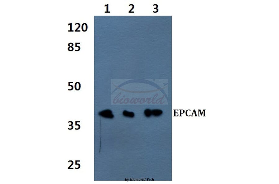 Anti-EPCAM (H150) Antibody from Bioworld Technology (BS1935) - Antibodies.com