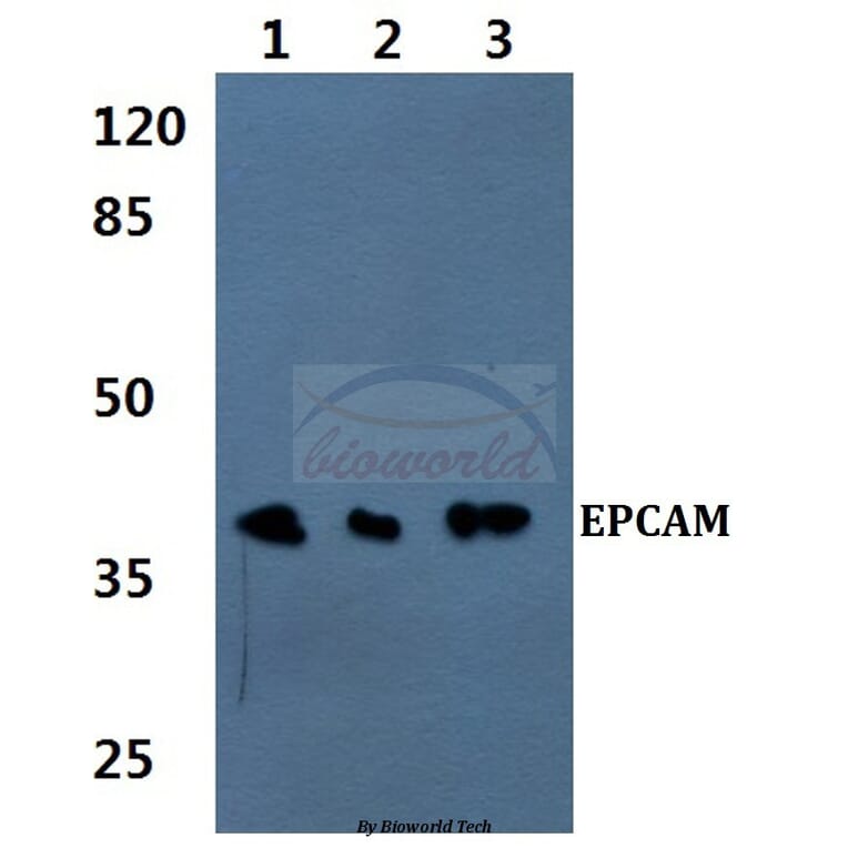 Anti-EPCAM (H150) Antibody from Bioworld Technology (BS1935) - Antibodies.com