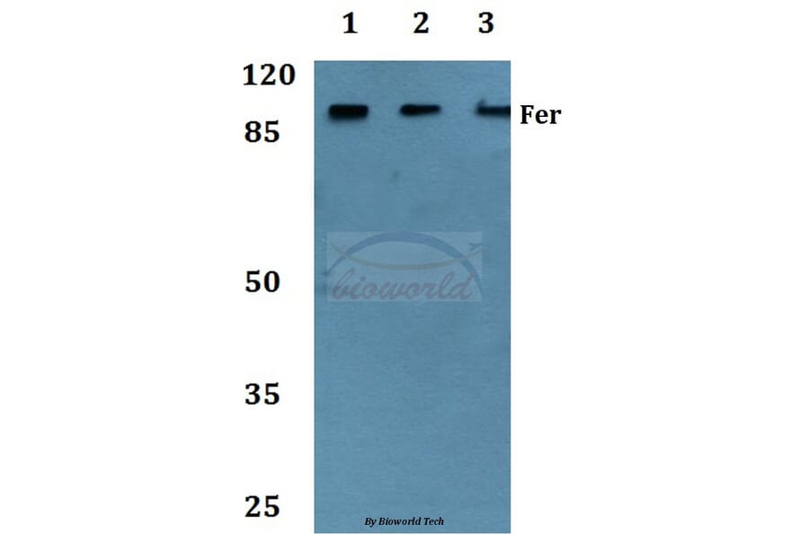 Anti-Fer (D798) Antibody from Bioworld Technology (BS1936) - Antibodies.com