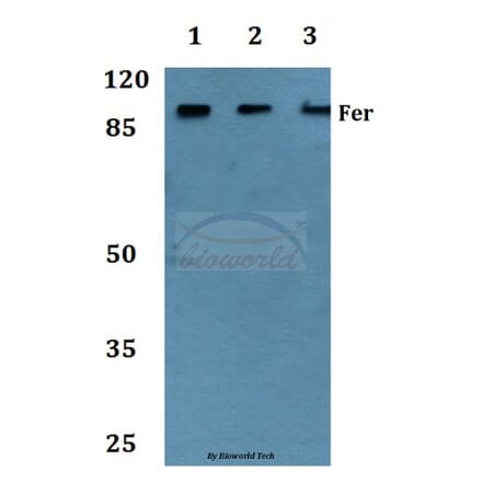 Anti-Fer (D798) Antibody from Bioworld Technology (BS1936) - Antibodies.com