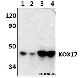Anti-KOX17 (K22) Antibody from Bioworld Technology (BS1938) - Antibodies.com