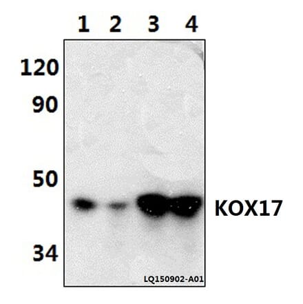 Anti-KOX17 (K22) Antibody from Bioworld Technology (BS1938) - Antibodies.com