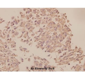 Anti-UBF-1 (E536) Antibody from Bioworld Technology (BS1939) - Antibodies.com