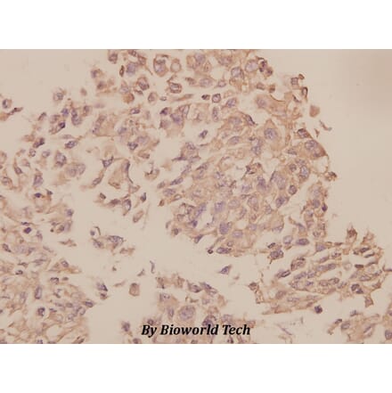 Anti-UBF-1 (E536) Antibody from Bioworld Technology (BS1939) - Antibodies.com