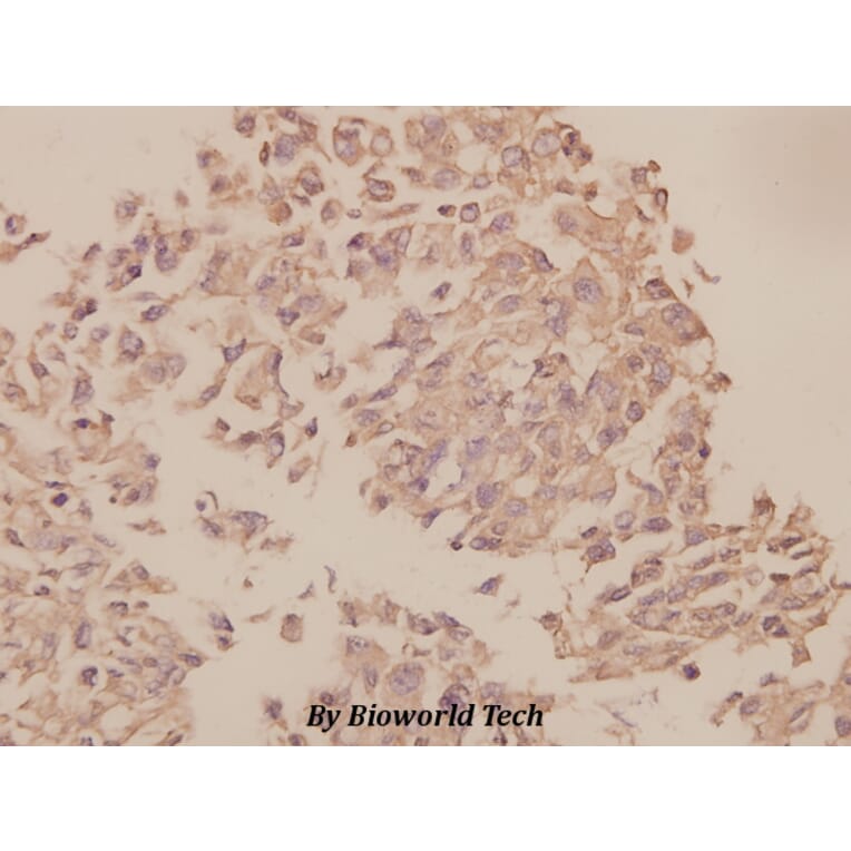 Anti-UBF-1 (E536) Antibody from Bioworld Technology (BS1939) - Antibodies.com