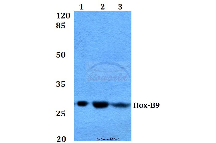 Anti-Hox-B9 (R237) Antibody from Bioworld Technology (BS1940) - Antibodies.com