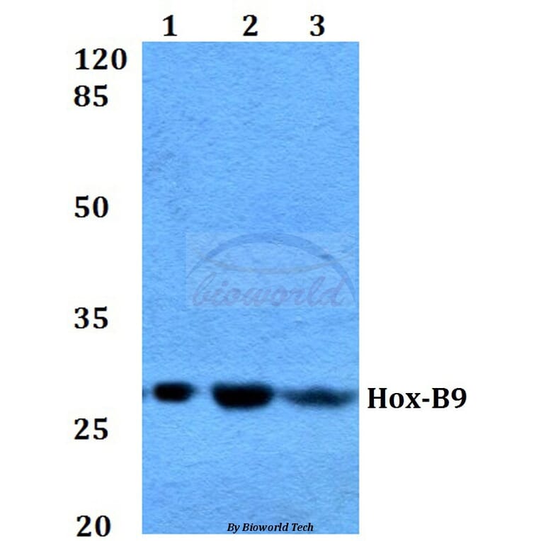 Anti-Hox-B9 (R237) Antibody from Bioworld Technology (BS1940) - Antibodies.com