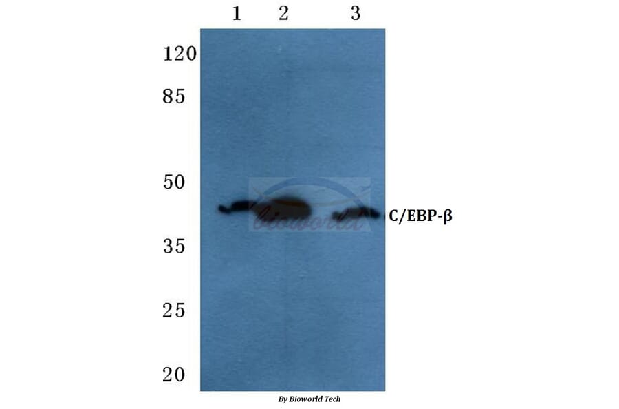 Anti-C/EBP-β (V259) Antibody from Bioworld Technology (BS1942) - Antibodies.com