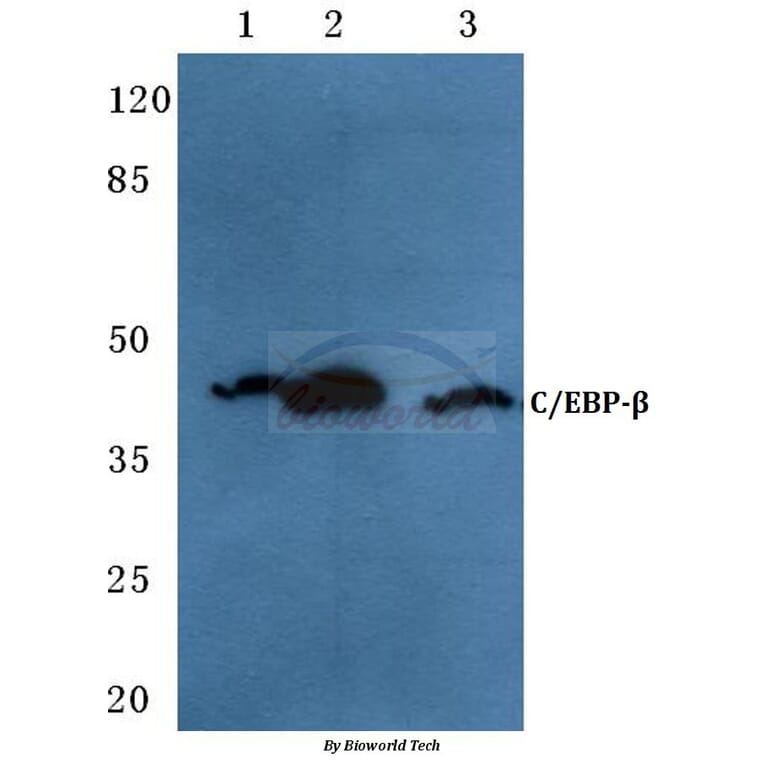 Anti-C/EBP-β (V259) Antibody from Bioworld Technology (BS1942) - Antibodies.com