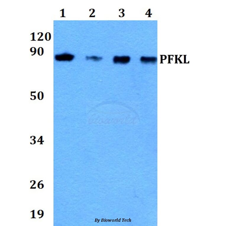 Anti-PFKL (E724) Antibody from Bioworld Technology (BS1943) - Antibodies.com