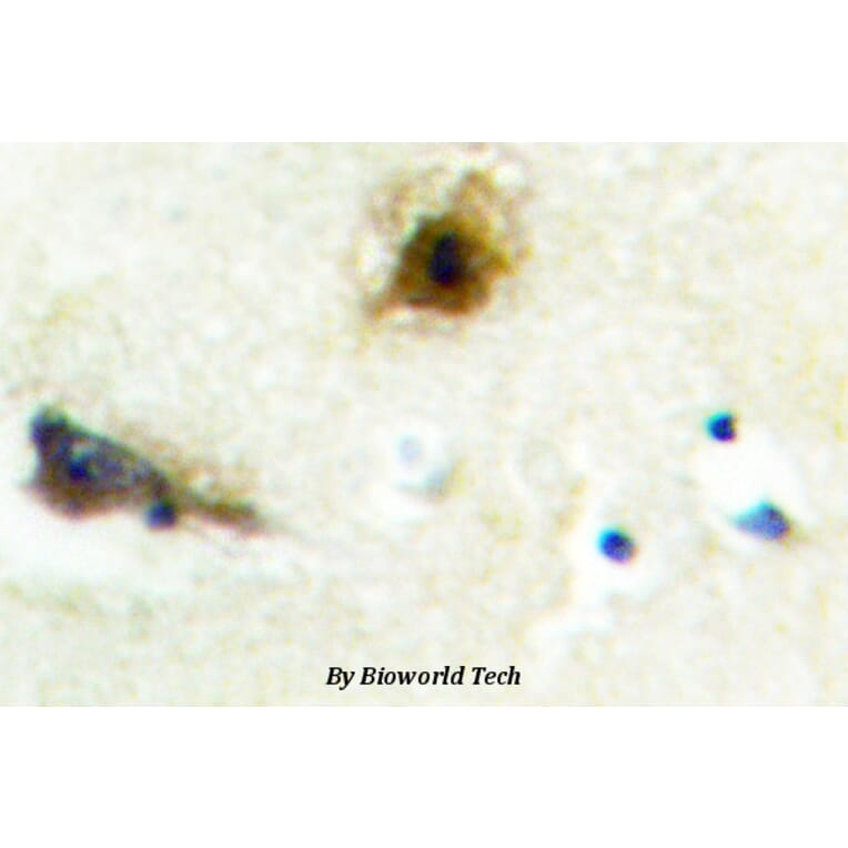 Anti-PFKL (E724) Antibody from Bioworld Technology (BS1943) - Antibodies.com