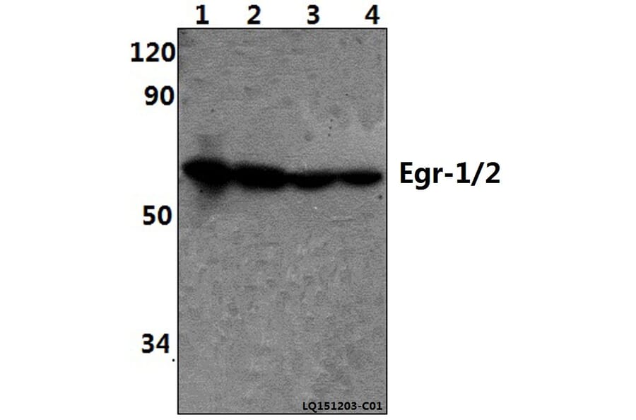Anti-Egr-1/2 (R409) Antibody from Bioworld Technology (BS1944) - Antibodies.com