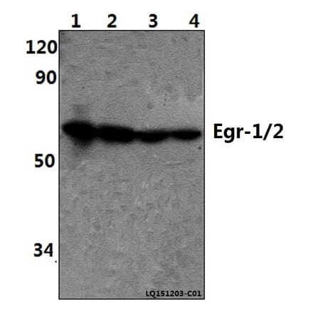 Anti-Egr-1/2 (R409) Antibody from Bioworld Technology (BS1944) - Antibodies.com