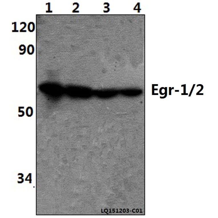 Anti-Egr-1/2 (R409) Antibody from Bioworld Technology (BS1944) - Antibodies.com