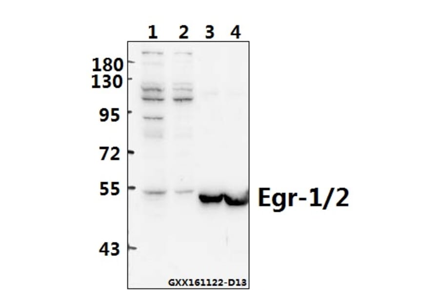 Anti-Egr-1/2 (R409) Antibody from Bioworld Technology (BS1944) - Antibodies.com