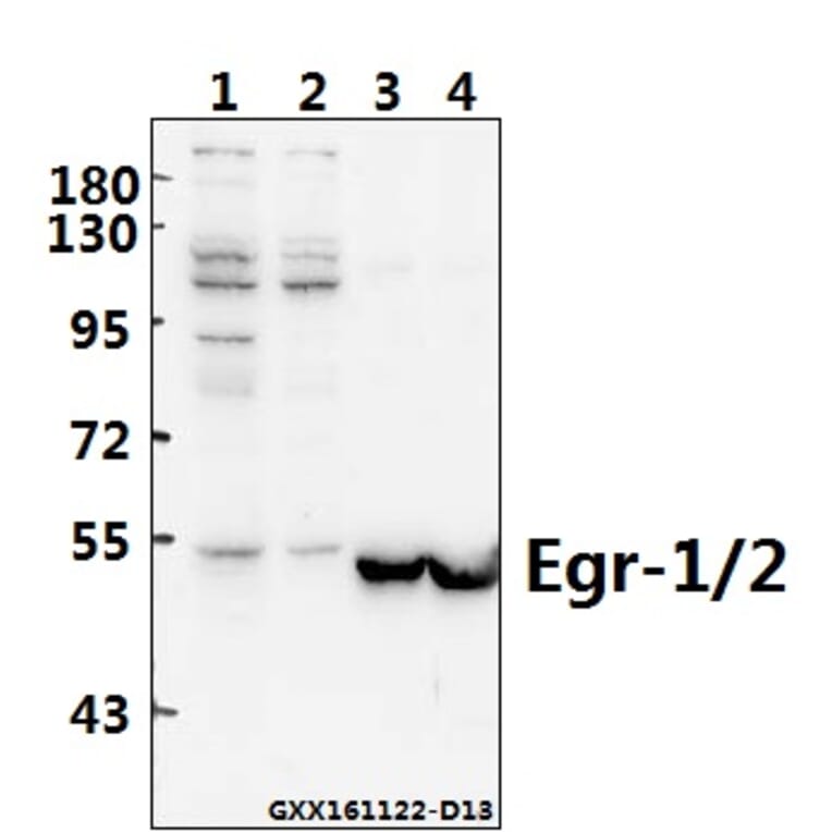 Anti-Egr-1/2 (R409) Antibody from Bioworld Technology (BS1944) - Antibodies.com