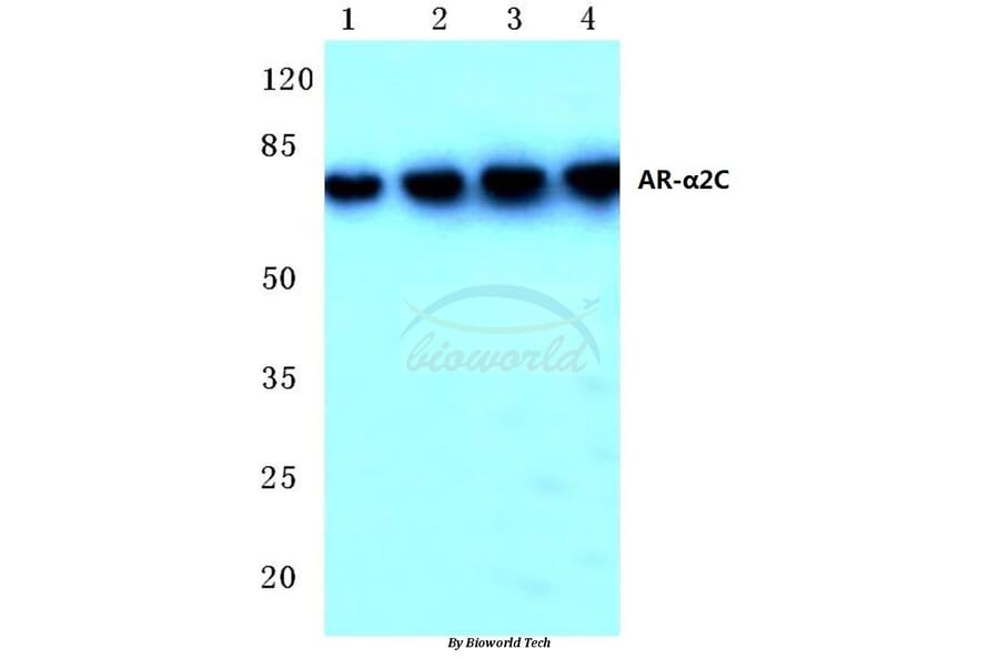 Anti-AR-α2C (R369) Antibody from Bioworld Technology (BS1945) - Antibodies.com