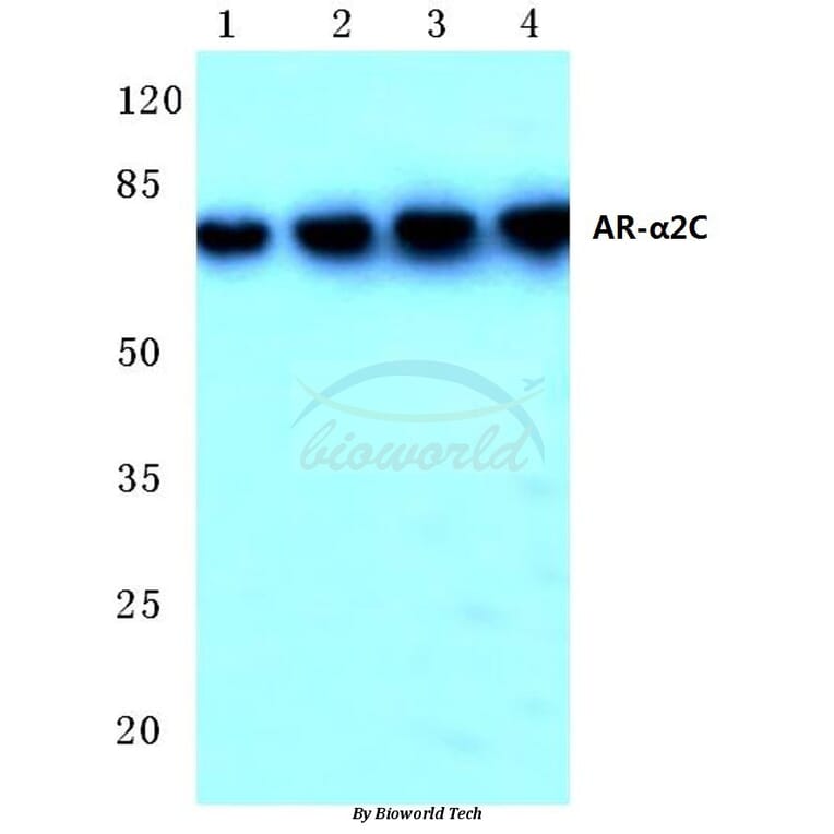 Anti-AR-α2C (R369) Antibody from Bioworld Technology (BS1945) - Antibodies.com